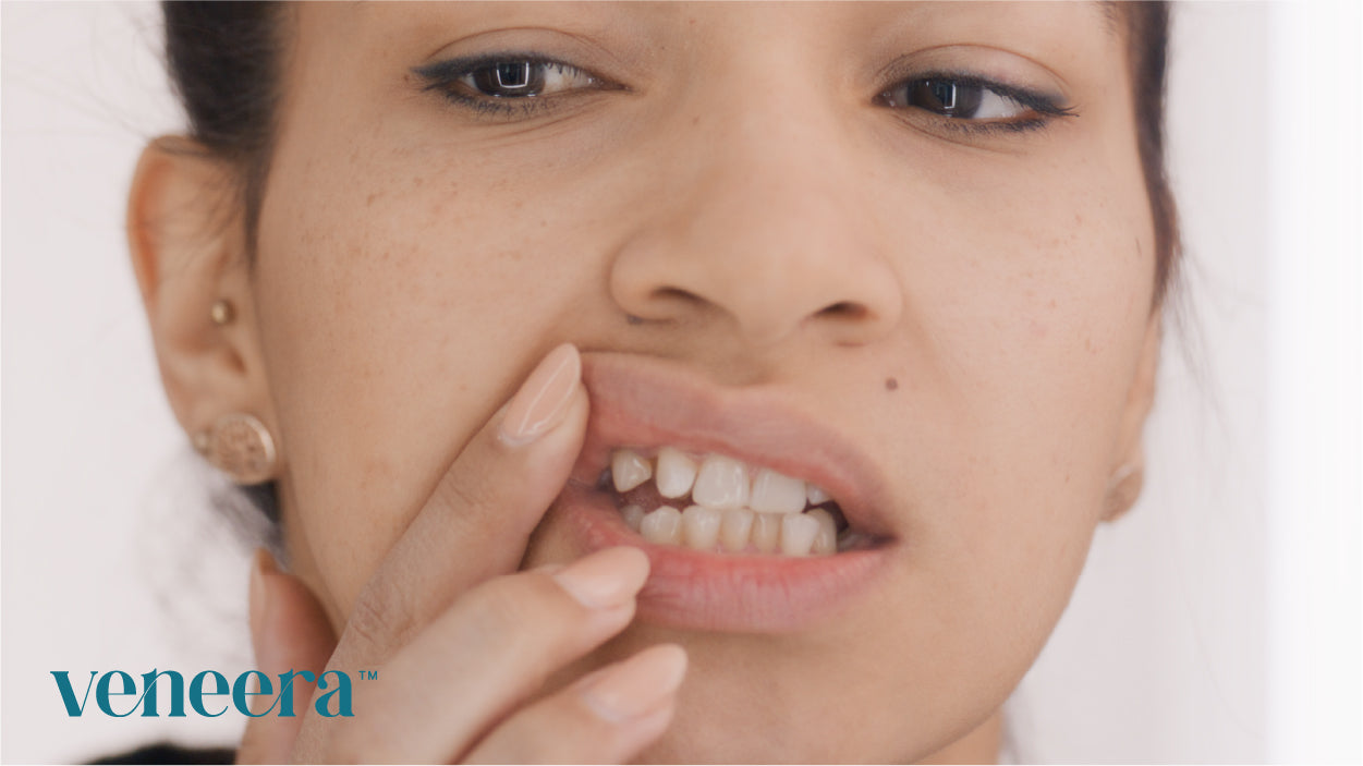 Tooth gaps and diastema - causes and possibilities