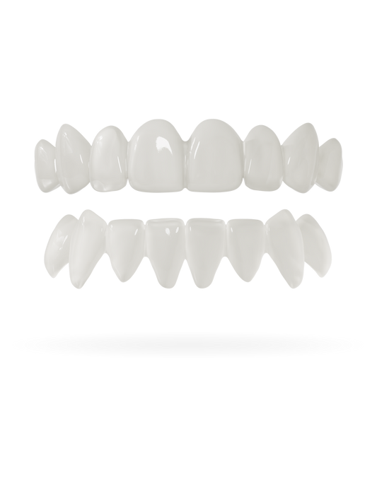 Teeth-Veneer top and bottom nature