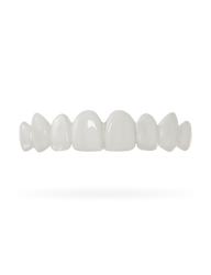 Teeth-Veneer upper jaw_nature