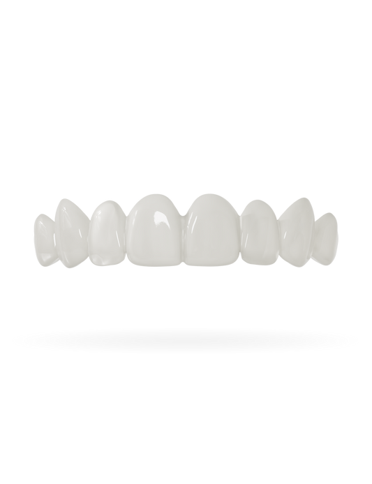 Teeth-Veneer upper jaw_nature