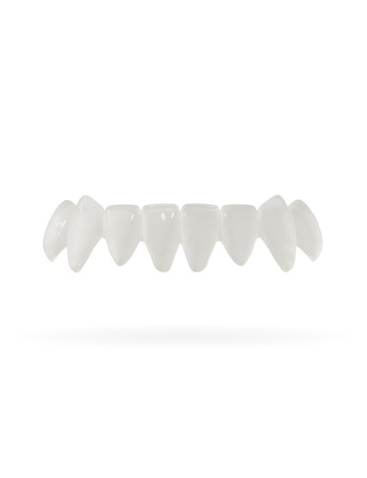 Veneera veneer lower jaw