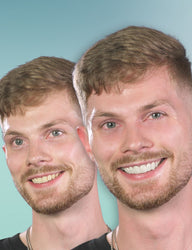 comparison of a man smiling with and without veneera veneer